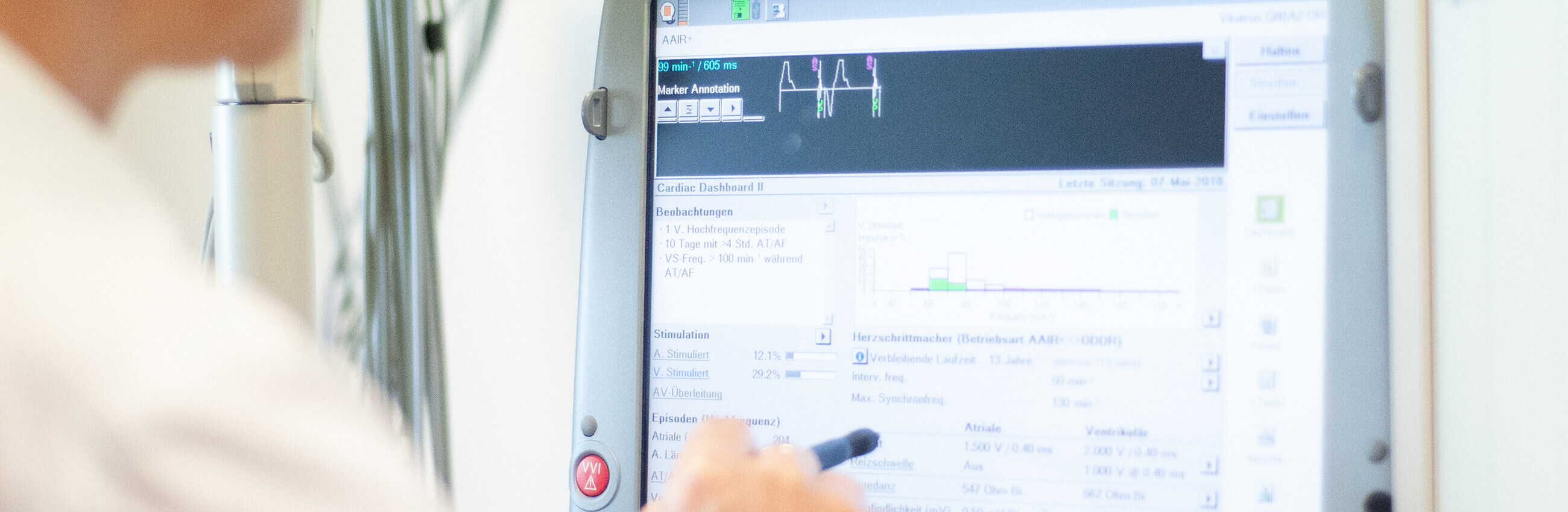 Digitale Überwachung herzkranker Patienten durch Telemedizin Telemedizin Kardiologie Rostock